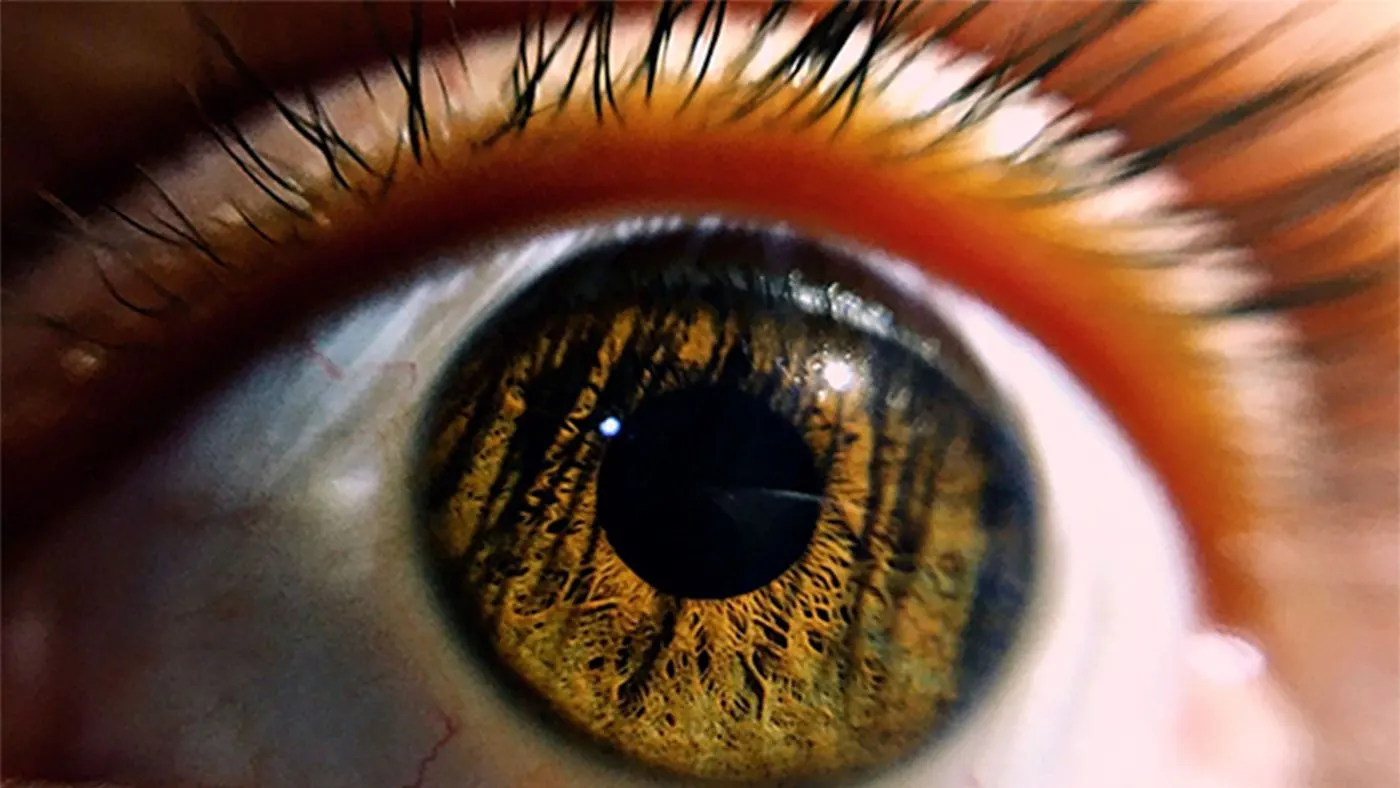 Primer plano extremo de un ojo humano con iris ámbar, imagen para la guía sobre ojos rojos y diabetes